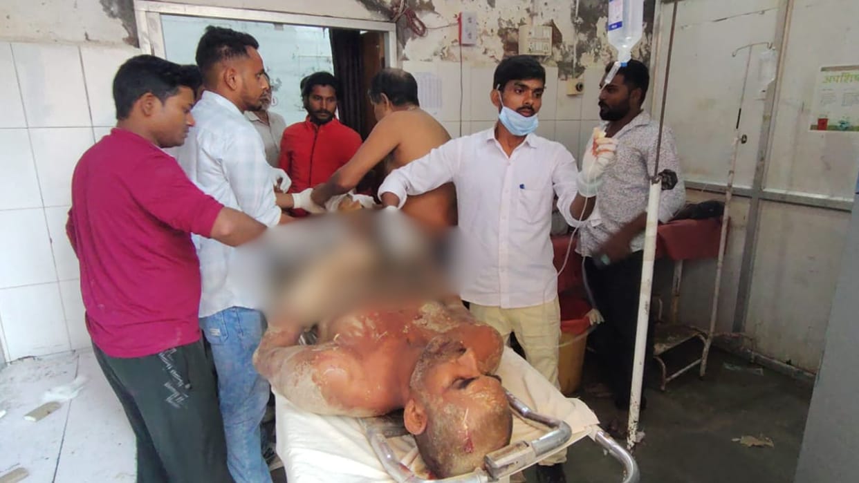 Shooting Bhadohi leaves three injured victims referred to Varanasi  violent clash erupts personal dispute