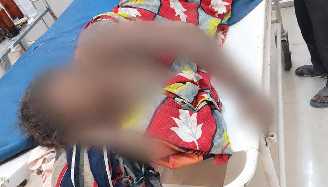 Kannauj Brutal act driven by grudge over elopement of wife accuseds mother doused with petrol and set on fire