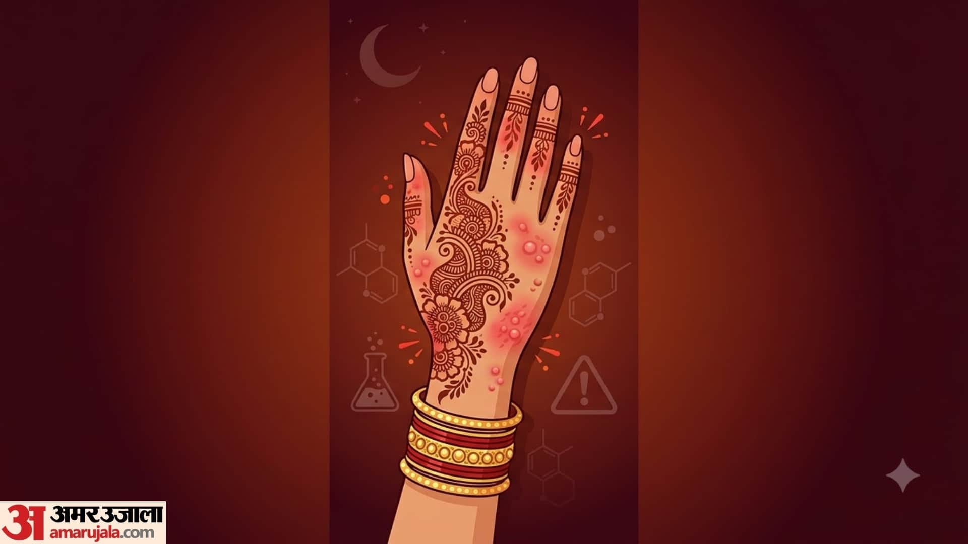 karwa chauth Mehndi Allergy: What to Do If Your Hands Burn or Itch After Applying Henna