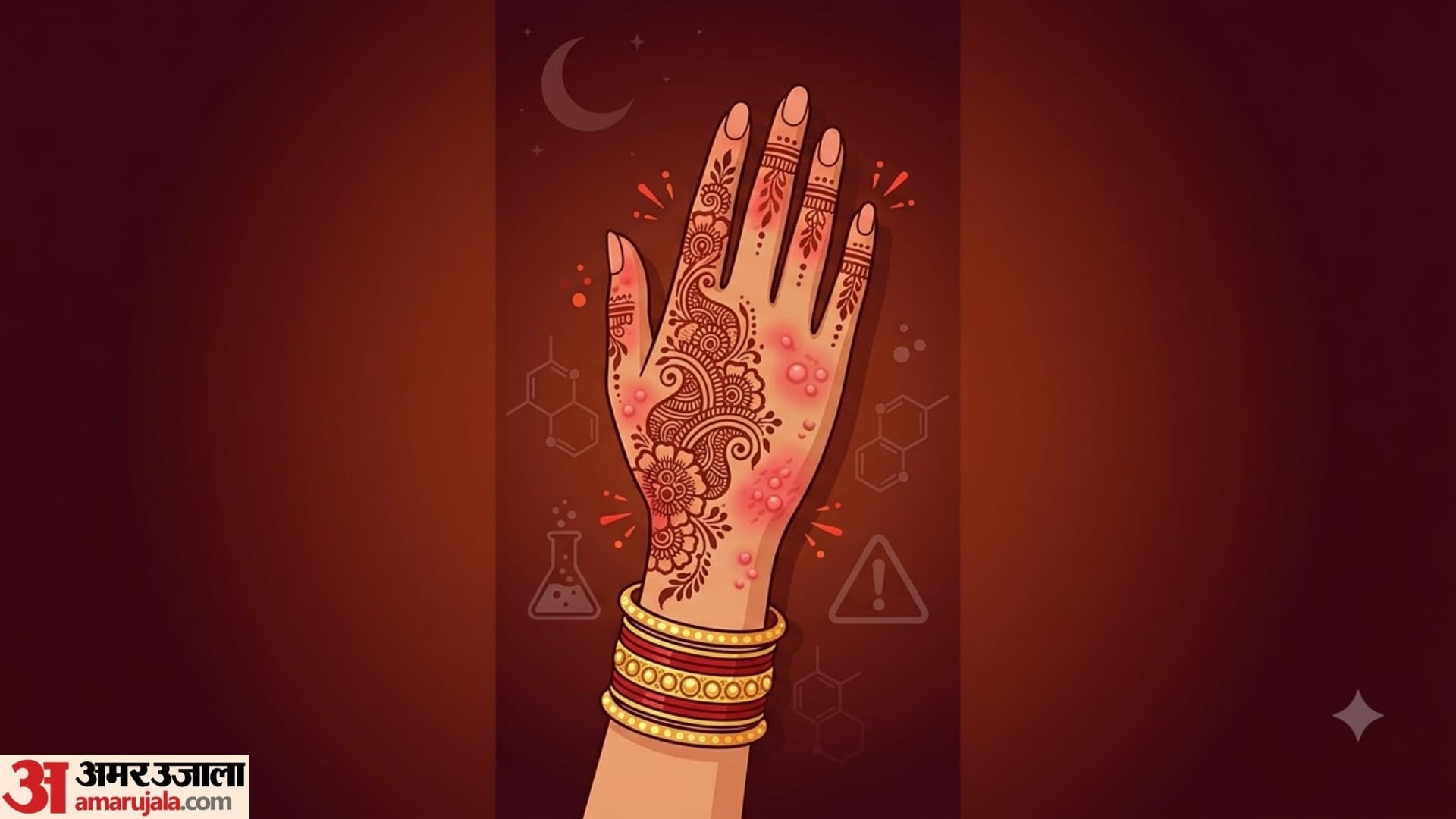 karwa chauth Mehndi Allergy: What to Do If Your Hands Burn or Itch After Applying Henna
