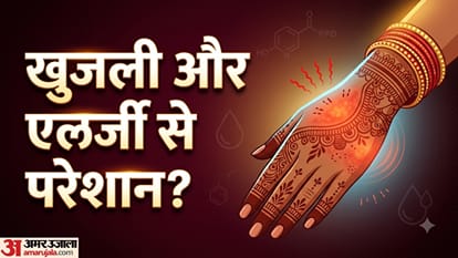 हाथों में जलन और खुजली हो तो घर पर कैसे पाएं राहत?