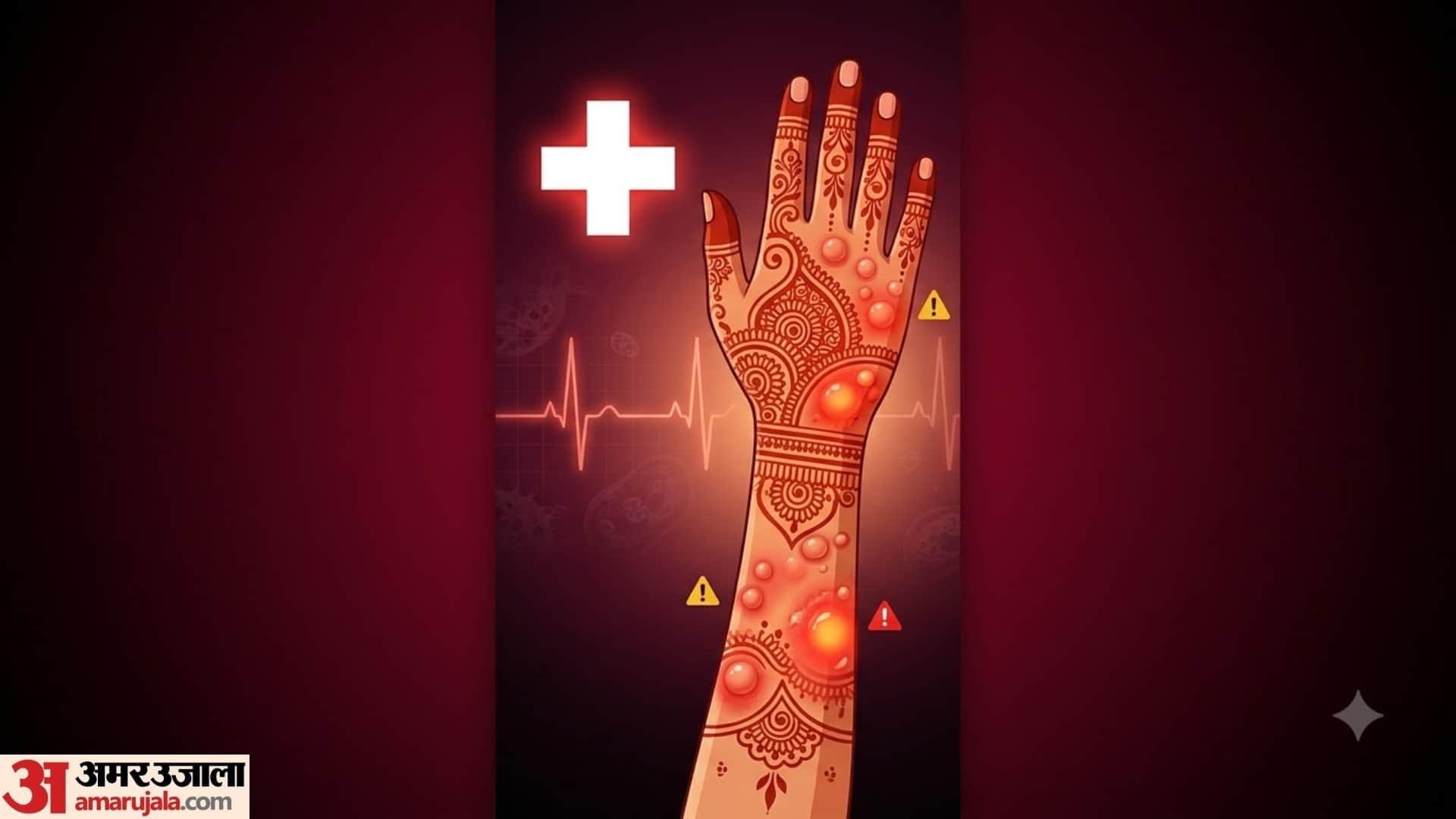 karwa chauth Mehndi Allergy: What to Do If Your Hands Burn or Itch After Applying Henna
