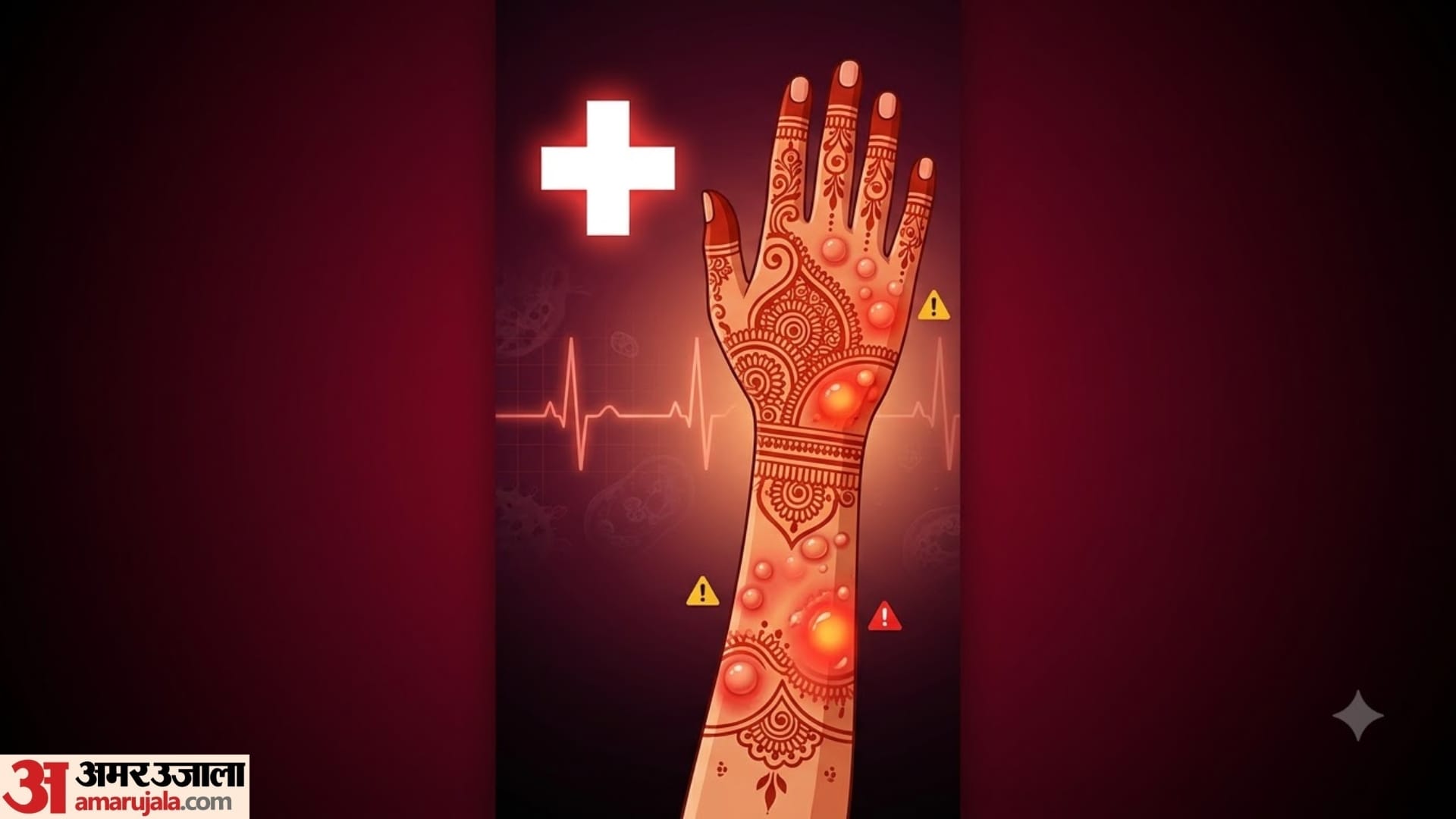 karwa chauth Mehndi Allergy: What to Do If Your Hands Burn or Itch After Applying Henna