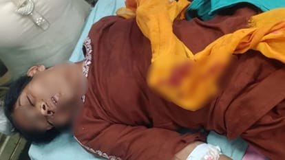अस्पताल में भर्ती घायल महिला