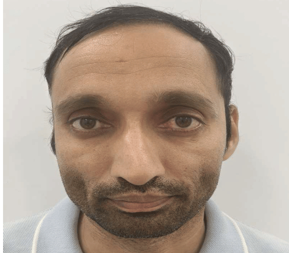 राजस्थान: फर्जी एफएमजीई सर्टिफिकेट से इंटर्नशिप करने का मामला, एक और डॉक्टर गिरफ्तार