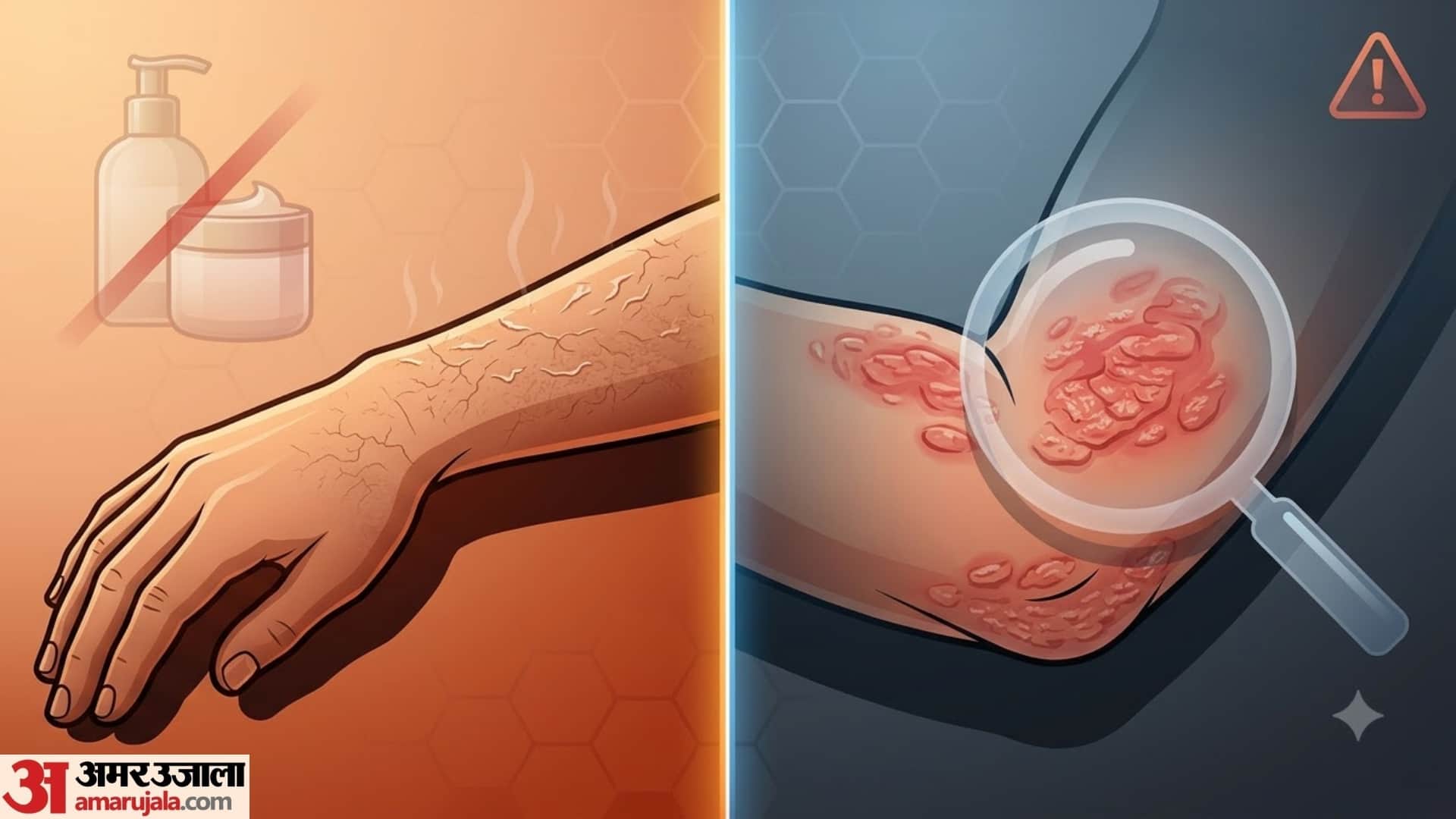 What Causes Dry Skin in Winter? Is Cold Weather the Only Reason?