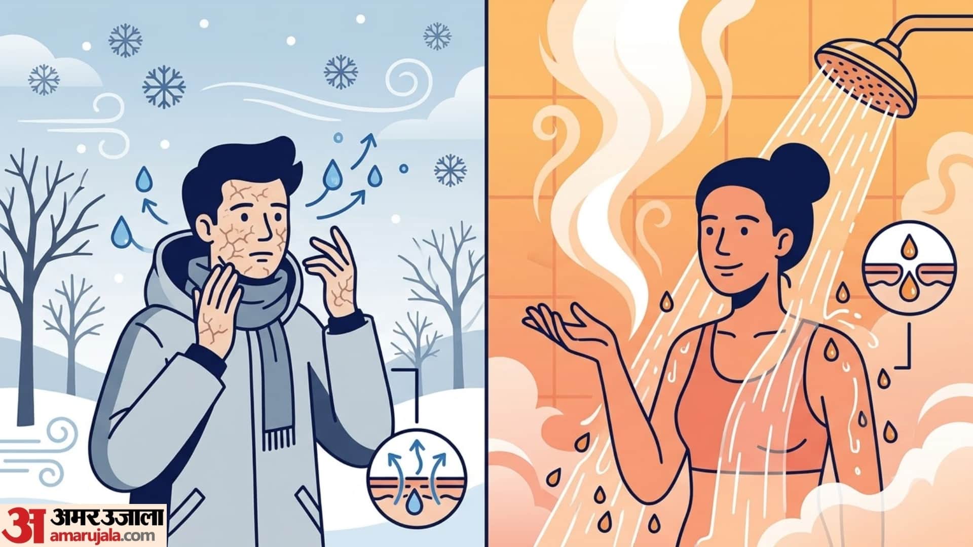 What Causes Dry Skin in Winter? Is Cold Weather the Only Reason?
