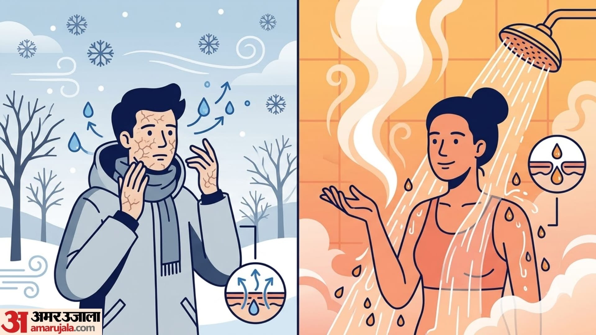 What Causes Dry Skin in Winter? Is Cold Weather the Only Reason?