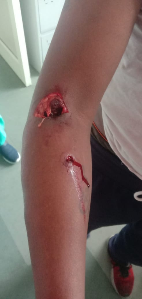 The dog bled the employee who went to pick up the garbage at the officer's house