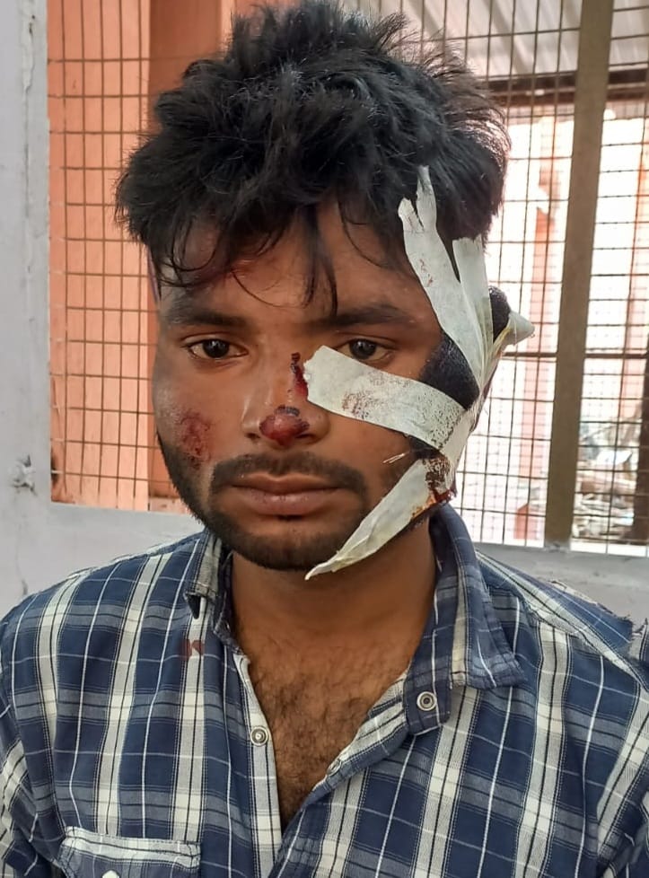 Nilgai collided with bike riding father and son, one died