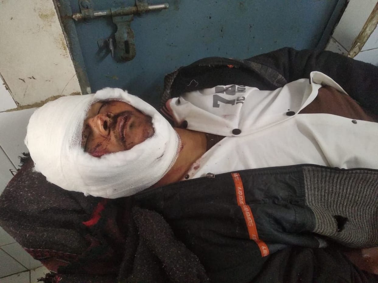 Three students going to collect Aadhaar card for exam injured in accident