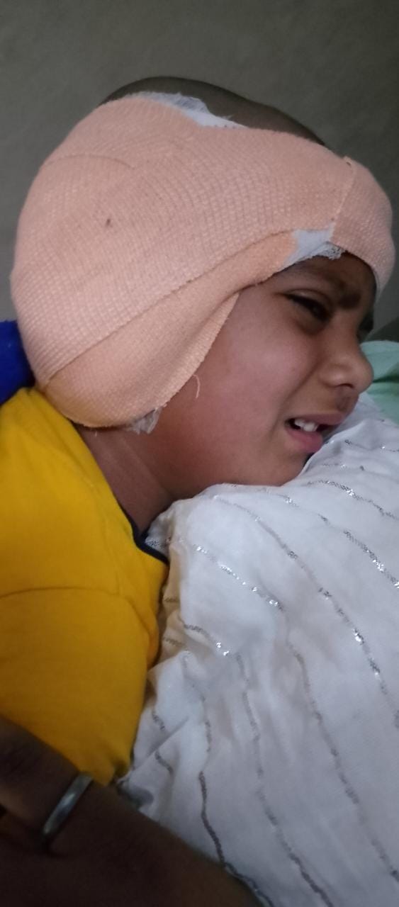 implant gonda ear child