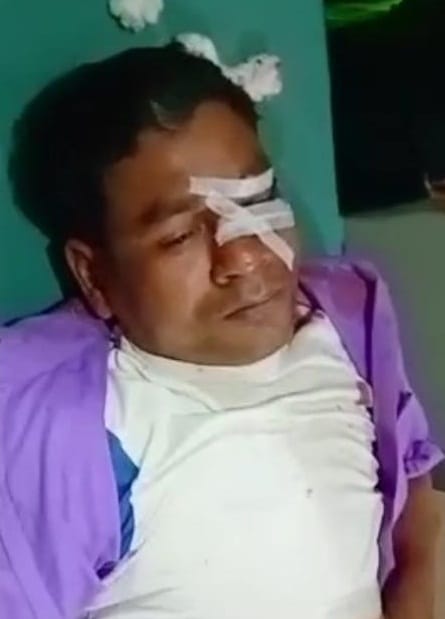 Deadly attack on shopkeeper, ran away with goods and cash