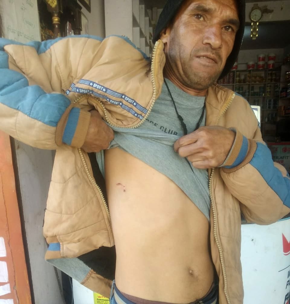 People face problems due to animal.