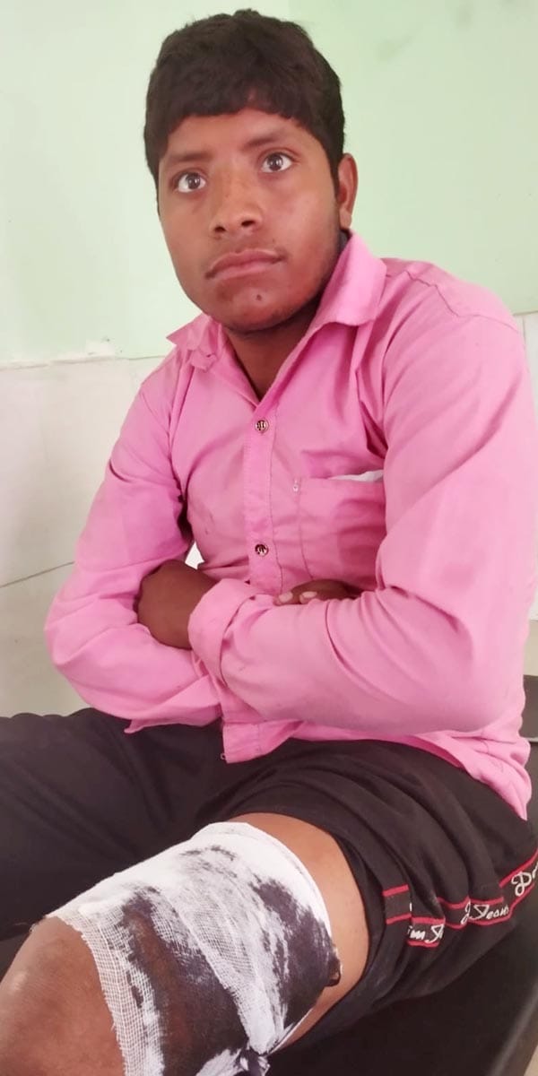 Wild boar attacked and injured a young man in Ujhani