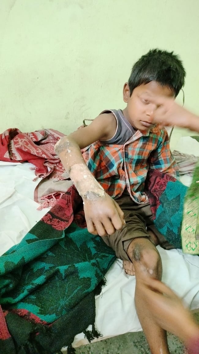 aag in injerd a child