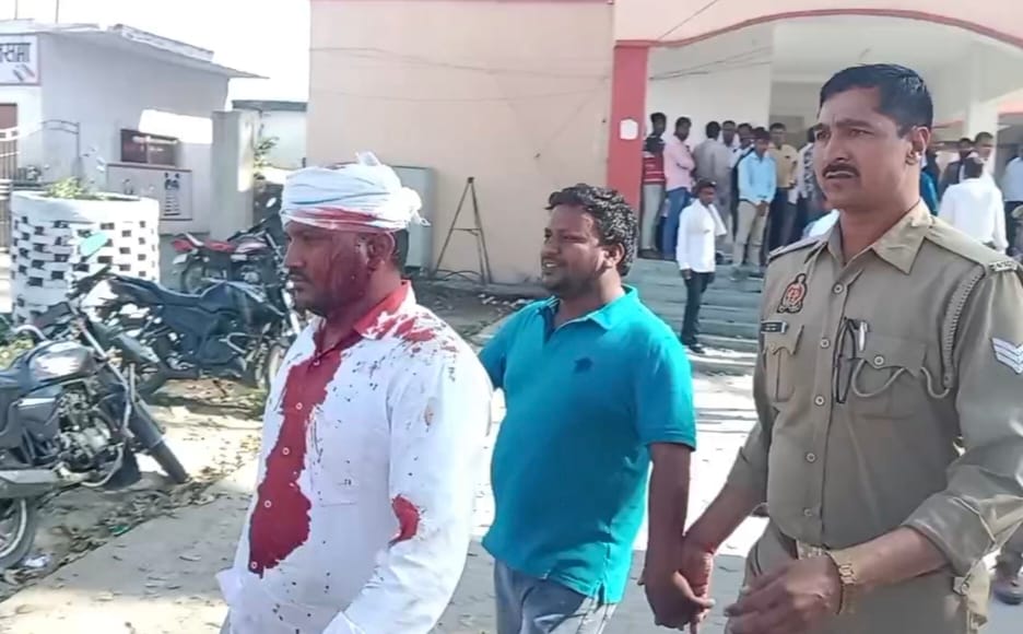 Two parties clashed in Dumariaganj tehsil for lease of taal, two injured
