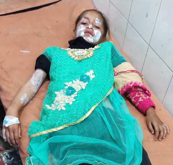 Girl scorched by lightning in Surkali village