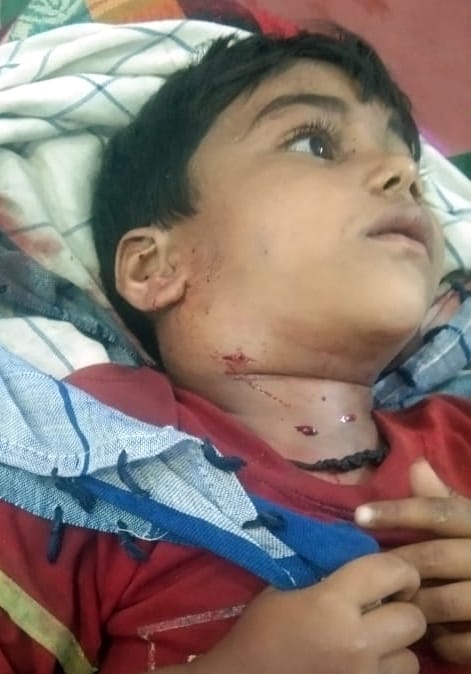 Guldar attacked and caught the child, the mother saved her life by showing courage