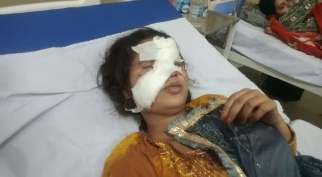 lover stabbed girl in face
