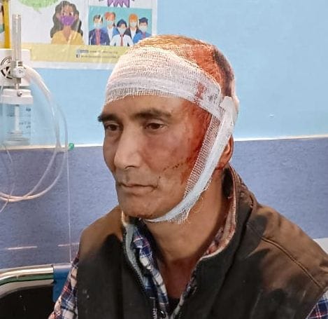 masked mercenary chilli injured