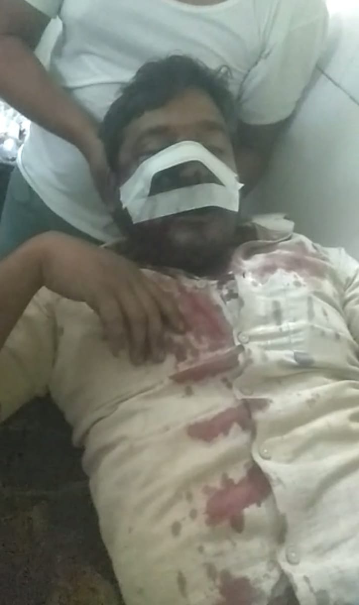 Dhaba operator shot in food dispute, serious