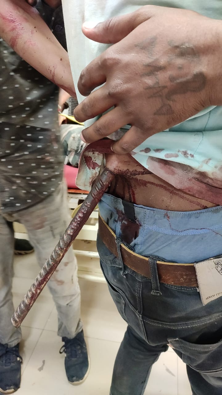 accident driver injured