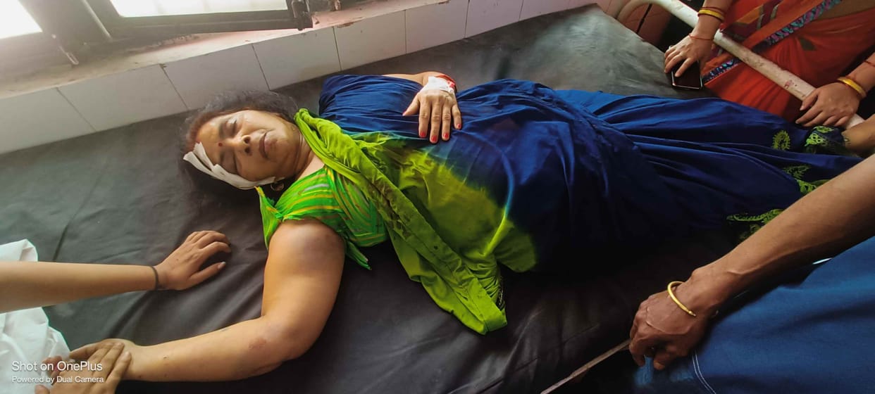 during chain snatching woman injured
