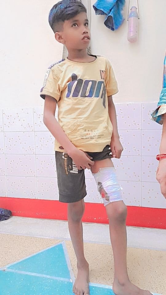 Mad dog attacks people, 12 injured