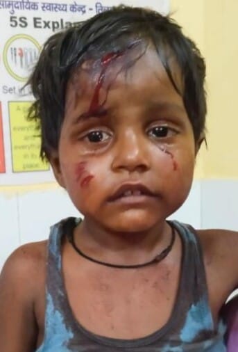 Neighbor's dog attacked four-year-old girl