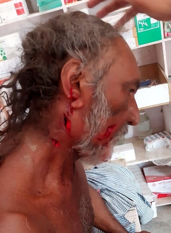 Tiger attacked and injured three people