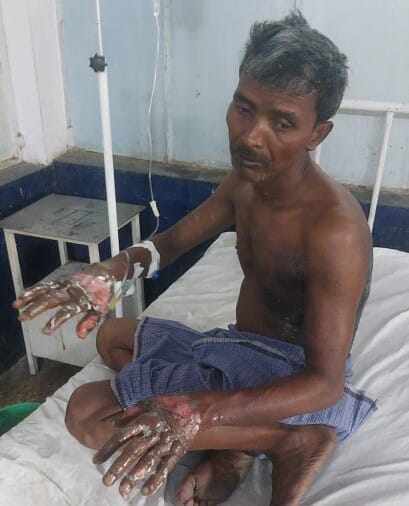 People set themselves on fire for stopping them from stealing electricity