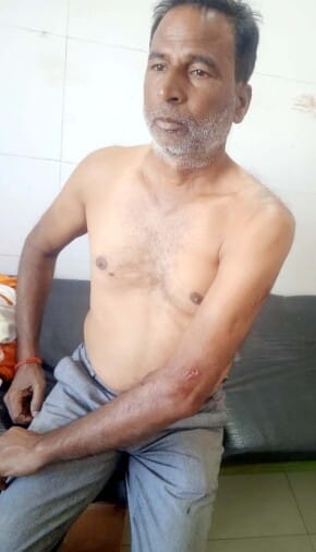 Tiger attacked the farmer who went to cut grass