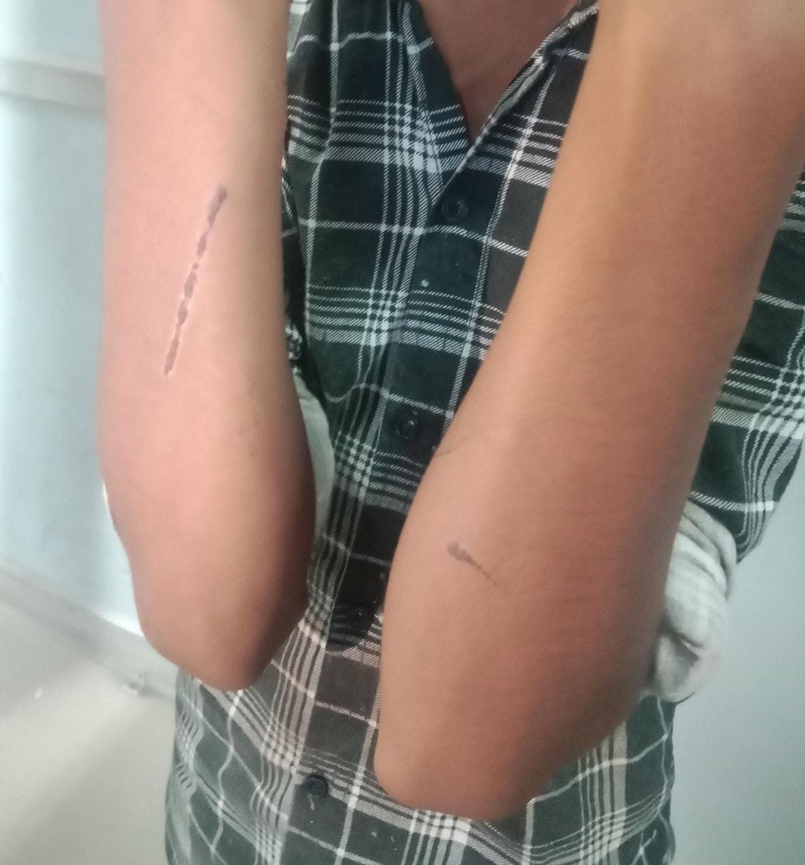 Teenager rescued from hotel, has injury marks on his body