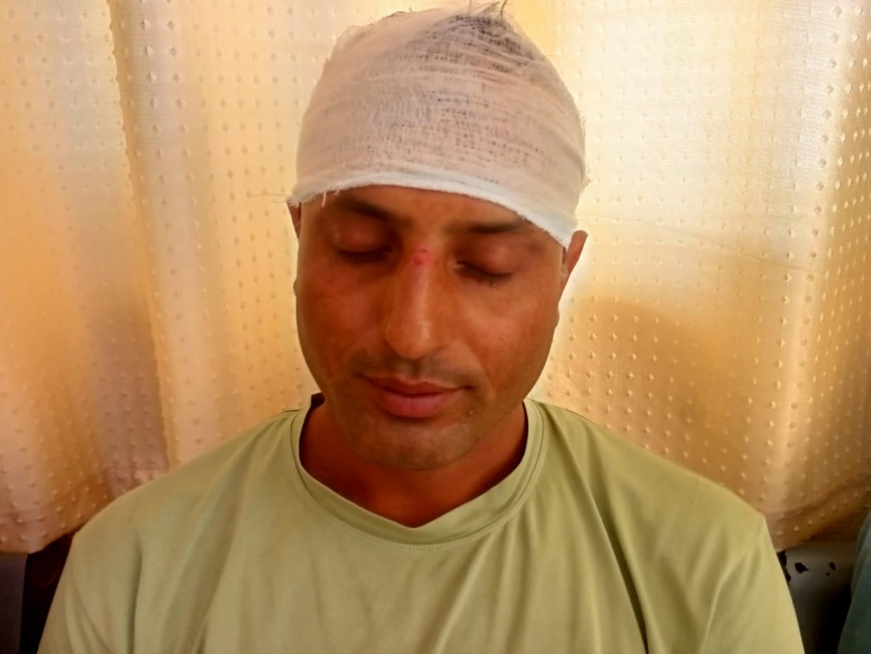 Two devotee couples beat policeman posted at the ghat pelted stones at the outpost Champawat Uttarakhand news