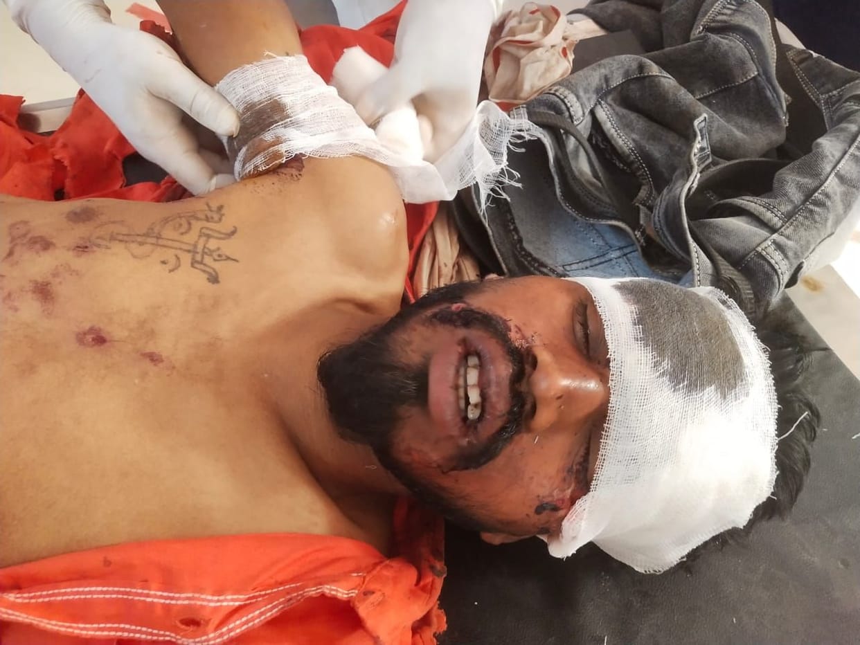 Youth injured after falling from express train, referred to PGI