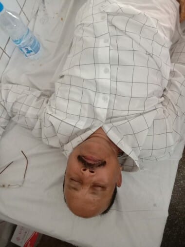 Fighting between revenue inspector and lawyers in Puranpur