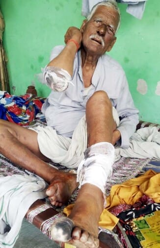 Kishore and his father injured in jackal attack