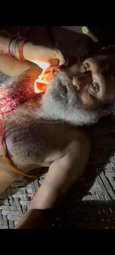 Temple priest attacked with sharp weapon, cut off beard hair