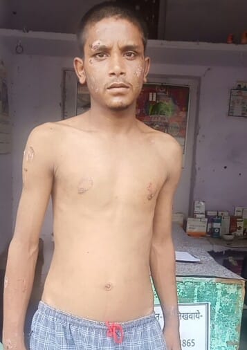 Worked day and night in the hotel, when wanted to come home, tied and beaten, cut from many places