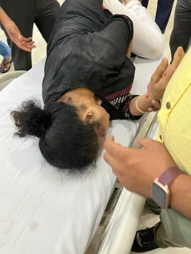 Miscreants snatched chain, woman injured after falling from bike