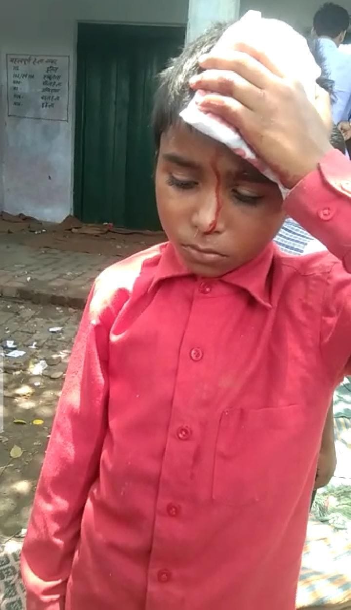 Student injured due to falling plaster of ceiling in school