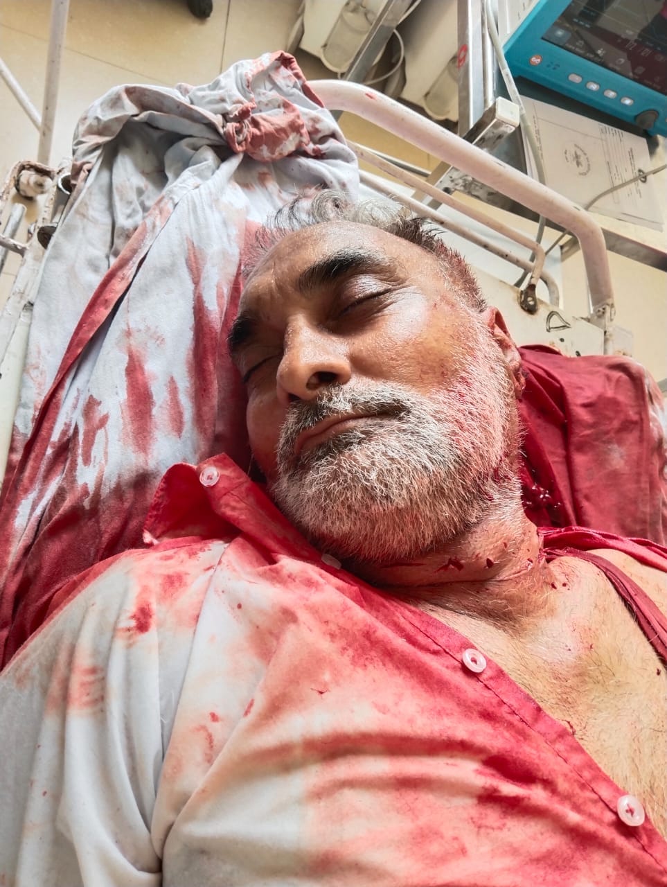 Controversy in rupee transaction, businessman hit bottle on his own neck