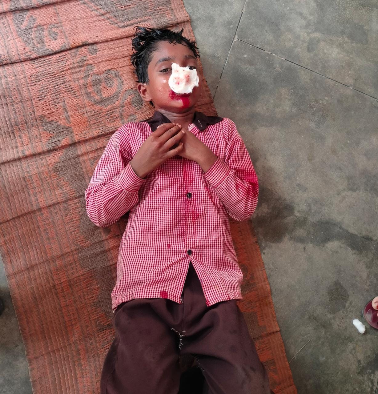 Student fell unconscious, blood came from other's nose