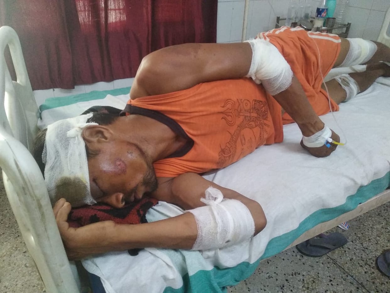 Accidents are not stopping in Bhavalkheda, two more kanwariyas were injured