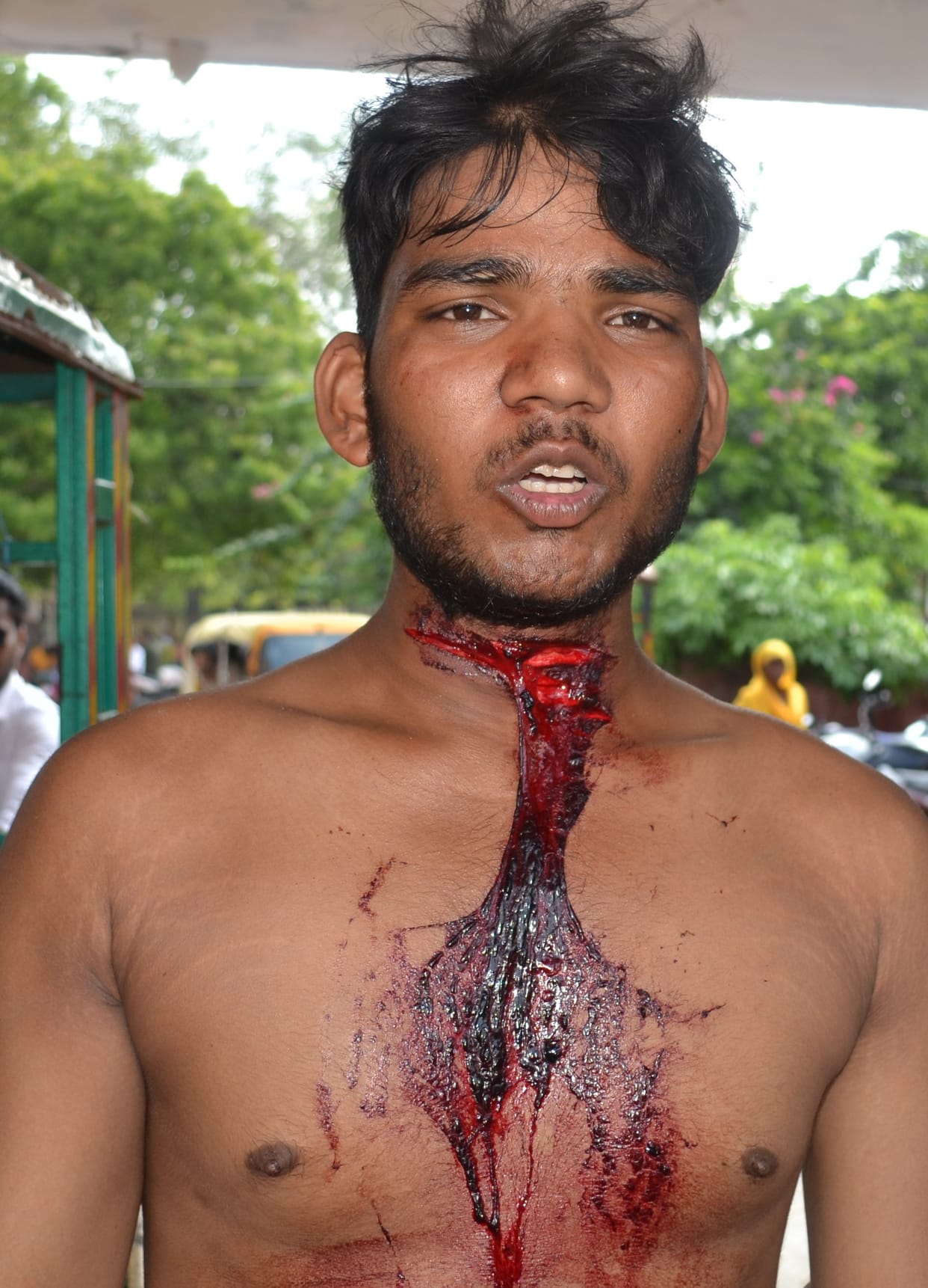Knife attack on young man's neck