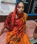 स्वास्थ्य केंद्र में भर्ती घायल गुड्डी देवी।