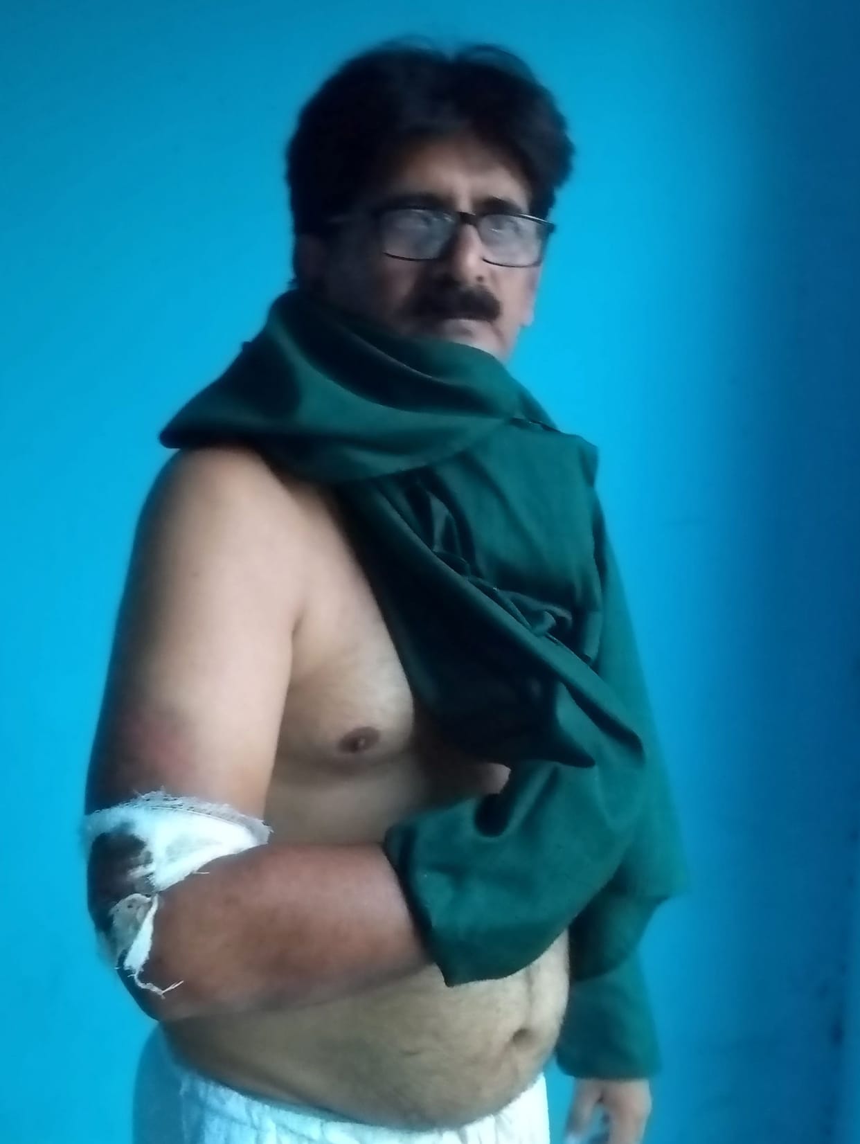 Lathis kept raining on the body, he kept running by covering his head with his hands: Anil