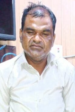 Accused of snatching chain coil arrested in Hardoi