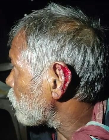 Eight including three children injured in Guldar's attack